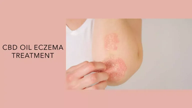 Using CBD Oil Eczema Treatment