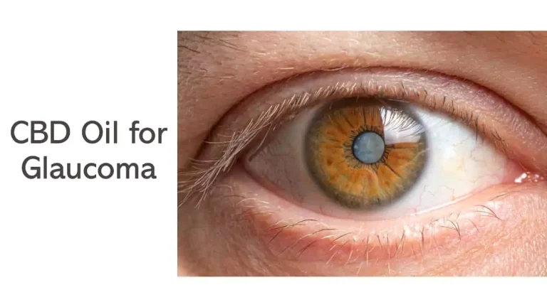 Using CBD Oil for Glaucoma